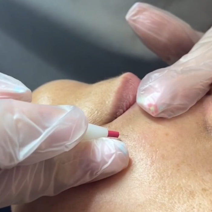 Épilation définitive par thermolyse à Paris avec Freed : efficace sur tous les types de poils
